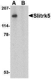 1 - Slitrk5 Antibody ASC10644