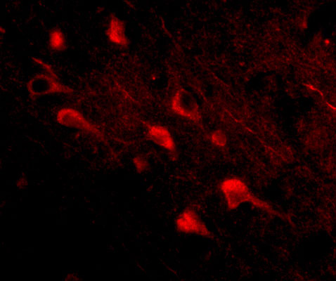 3 - Slitrk5 Antibody ASC10645