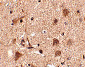 2 - Slitrk5 Antibody ASC10645