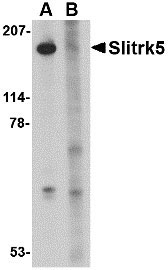 1 - Slitrk5 Antibody ASC10645