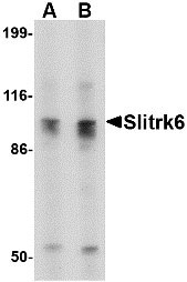 1 - Slitrk6 Antibody ASC10646