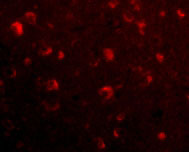 3 - Slitrk6 Antibody ASC10647