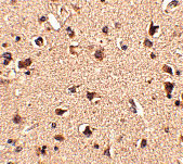 2 - Slitrk6 Antibody ASC10647
