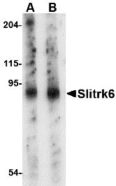 1 - Slitrk6 Antibody ASC10647