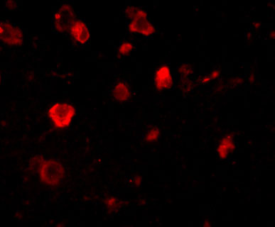3 - Slitrk4 Antibody ASC10648