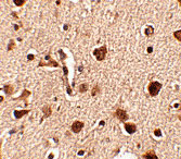 2 - Slitrk4 Antibody ASC10648