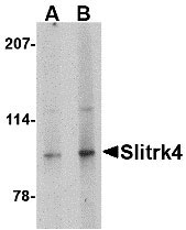 1 - Slitrk4 Antibody ASC10648
