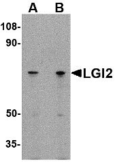 1 - LGI2 Antibody ASC10652