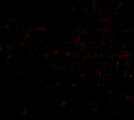 3 - BRAL1 Antibody ASC10655