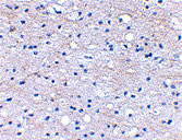 2 - BRAL1 Antibody ASC10655