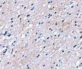 2 - BAP3 Antibody ASC10656