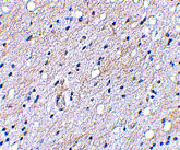 2 - BAP3 Antibody ASC10657