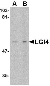1 - LGI4 Antibody ASC10659