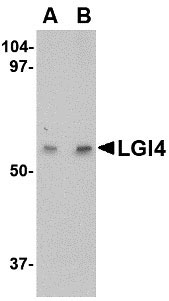 1 - LGI4 Antibody ASC10660