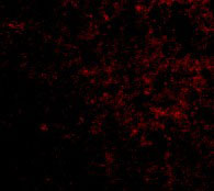 3 - LGI2 Antibody ASC10664
