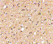 2 - LGI2 Antibody ASC10664