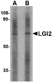 1 - LGI2 Antibody ASC10664