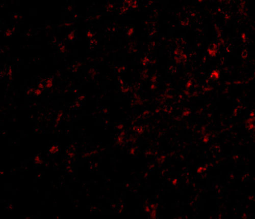 3 - NIPSNAP Antibody ASC10666