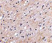 2 - NIPSNAP Antibody ASC10666
