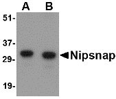 1 - NIPSNAP Antibody ASC10666