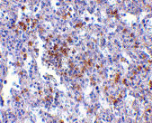 2 - EVER1 Antibody ASC10672