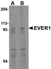 1 - EVER1 Antibody ASC10672