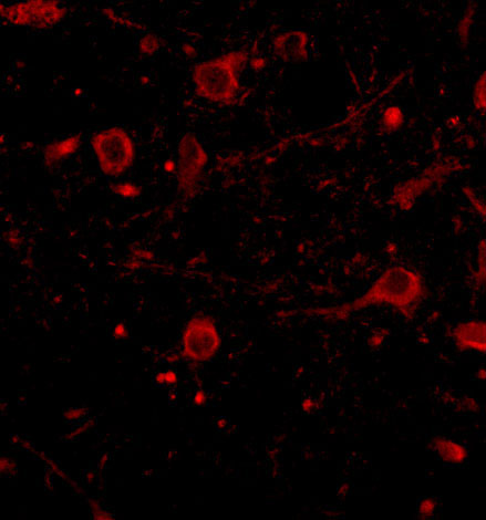 3 - CAPS1 Antibody ASC10677