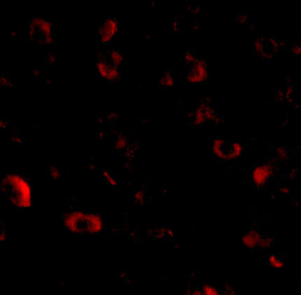 3 - CAPS1 Antibody ASC10678