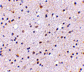 2 - CAPS1 Antibody ASC10678