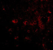 3 - CAPS2 Antibody ASC10679