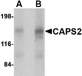 1 - CAPS2 Antibody ASC10679