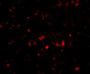 3 - NPTX2 Antibody ASC10682