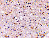 2 - NPTX2 Antibody ASC10682