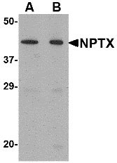 1 - NPTX2 Antibody ASC10682