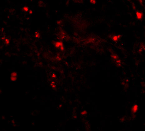 3 - RGPD5 Antibody ASC10683