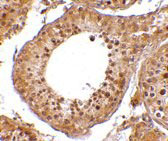 2 - RGPD5 Antibody ASC10683