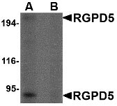 1 - RGPD5 Antibody ASC10684