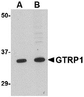 1 - GRTP1 Antibody ASC10685