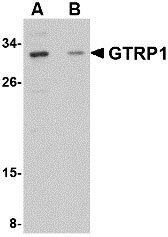 1 - GRTP1 Antibody ASC10686
