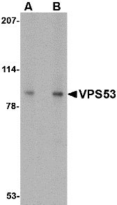 1 - VPS53 Antibody ASC10687