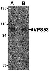 1 - VPS53 Antibody ASC10688