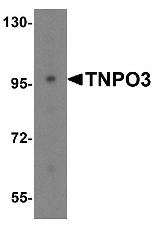 1 - TNPO3 Antibody ASC10689