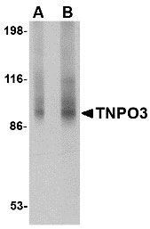 1 - TNPO3 Antibody ASC10690
