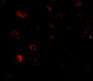 3 - Rim2 Antibody ASC10694
