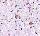 2 - Rim2 Antibody ASC10694