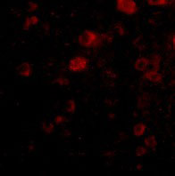 3 - VGF Antibody ASC10695