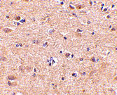 2 - VGF Antibody ASC10695