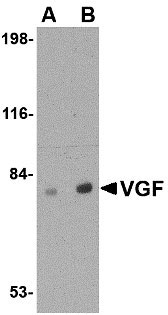1 - VGF Antibody ASC10695