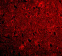 3 - GPAT1 Antibody ASC10696