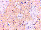 2 - GPAT1 Antibody ASC10696